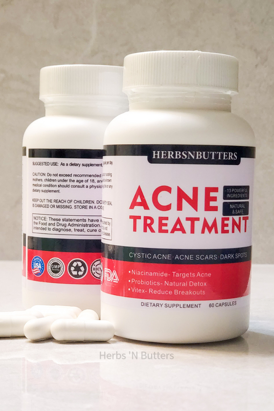 Hormonal Acne Supplement